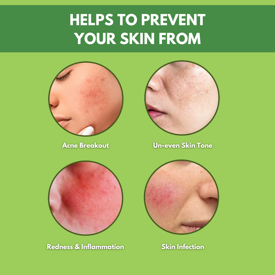 Dermatologist-Approved Acne Fixing Soap | NeemIndulge