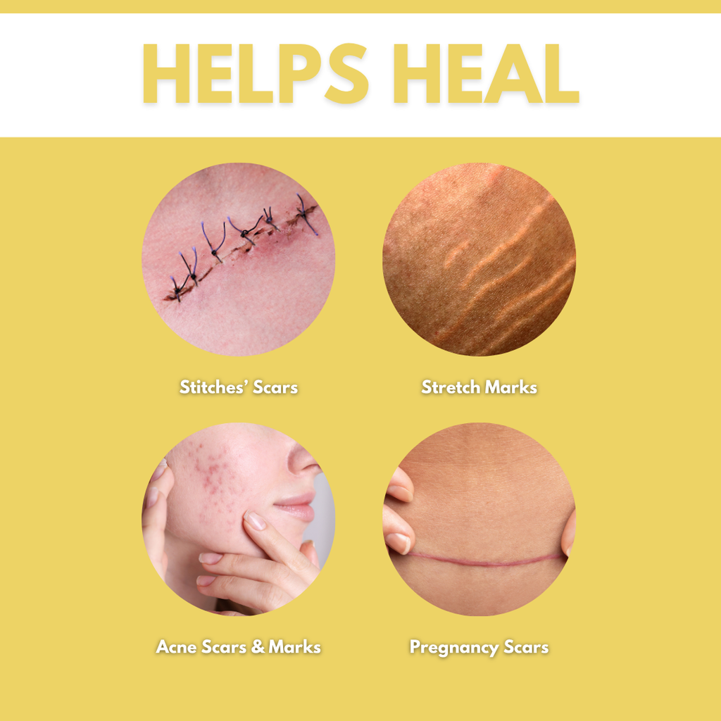 "SCARS" Gel